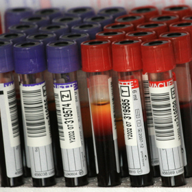 4. Lidé s krevní skupinou 0. Podle jednoho výzkumu mají lidé s touto krevní skupinou až 89% šanci, že si krvelačný komár vybere právě je.