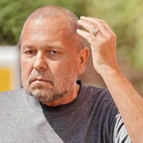 Po začátku chemoterapie začaly Jiřímu vypadávat vlasy.