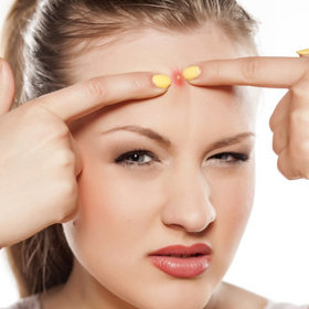 Pupínky nikdy nemačkejte, hrozí vám infekce