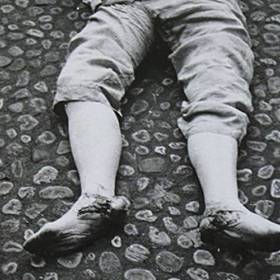 Ministr zahraničí měl zranění neslučitelná se životem