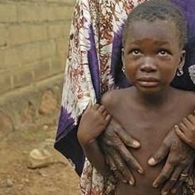 V očích dětí vidíte strach