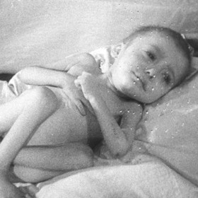 Mengele rád mučil hlavně děti.