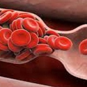 Dnes je světový den hemofilie