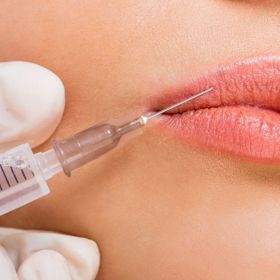 Zvětšení rtů za pomoci botoxu.