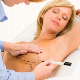 Modelaci prsou podstupují většinou ženy po dětech.