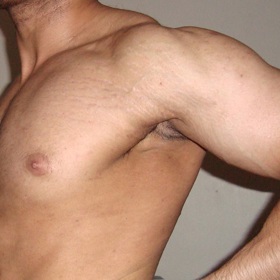 Navštěvujete-li posilovnu, zvyšujte zátěž postupně. Začínejte spíše s lehčí zátěží a vždy se dobře poraďte s trenérem. Po cvičení si kůži promasírujte mastným krémem.