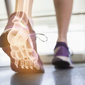 Dodržujte správnou techniku chůze