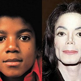Michael Jackson měnil barvy kůže více než chameleon. Jeho touha stát se bílým mu přivodila velké zdravotní problémy