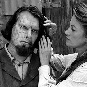 Některé chirurgické zákroky značně předčily svou dobu. Třeba transplantace obličeje. Ta byla úspěšně provedena až v roce 2005.