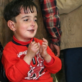 Chlapec trpící epidermolysis bullosa neboli nemocí motýlích křídel.