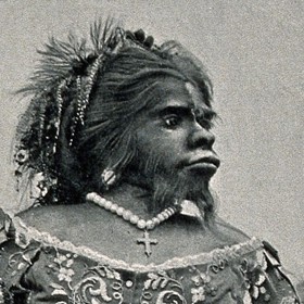 Julia Pastrana (1834 – 25. březen 1860) byla mexická zpěvačka a umělkyně, která trpěla vzácnou nemocí hypertrichózou. Ta se projevuje nadměrným růstem ochlupení. Pacientům postiženým touto chorobou se dříve říkalo vlčí či vlkodlačí lidé.