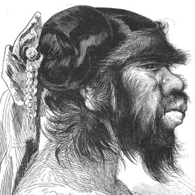 Pacientům postiženým touto chorobou se dříve říkalo vlčí či vlkodlačí lidé.