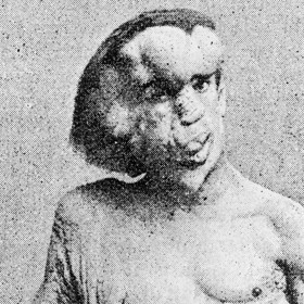 Joseph Merrick byl Angličan s těžkými tělesnými deformacemi. Přezdívku Sloní muž získal v panoptiku. V období dospívání se však nemohl spolehnout ani na vlastní rodinu. Všichni se mu smáli.
