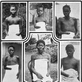 Kromě mrzačení také docházelo k častým únosům dětí.
