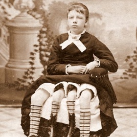 Kromě postižení od pasu dolů její tělo fungovalo docela normálně.