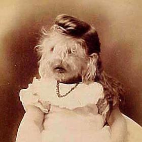 Maličká Alice Doherty musela budit hrůzu. Která matka by se chtěla smířit s takovým postižením svého dítěte? 