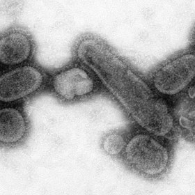 Na obrázku jsou viriony chřipky pod elektronovým mikroskopem. Lékaři doporučovali klid na lůžku, izolaci, a dokonce i konzumaci alkoholu. 