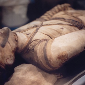 S tuberkulózou se potýkali lidé už v dávné historii. Jasné důkazy nákazy její přítomnosti našli vědci již při studiu starých egyptských mumií.