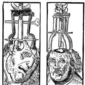 Co na migrénu, když nejsou léky? Přece díra do hlavy. Doporučuje se i pacientům s psychickými problémy...