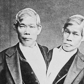 Chang a Eng Bunkerovi těžili celý život ze své odlišnosti. Ve vyšším věku se ale snažili o oddělení, což jim lékaři nedoporučili. A pitva později ukázala, že dobře udělali. Bratři by rozdělení nepřežili.