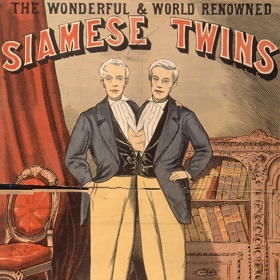 Jak se v polovině 19. století mohli živit lidé, kteří dostali do vínku nějakou odlišnost? Stačilo se ukazovat v cirkusu, na náměstí nebo na pódiu. Lidé rádi zaplatili.