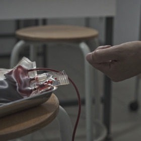 Nejvíce se do Francie vozila z USA, kde se tehdy rozmohl vysoce nakažlivý AIDS. Nikdo ale moc nezkoumal, jak je ve skutečnosti rozšířený a jestli jej nemají i dárci krve.