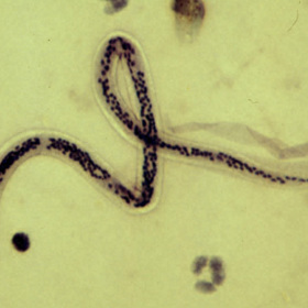 Tento vlasovec si libuje v mízních uzlinách. Larvy měří i několik desítek centimetrů...