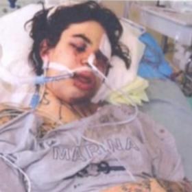 Nela Moravcová v nemocnici po brutálním útoku.