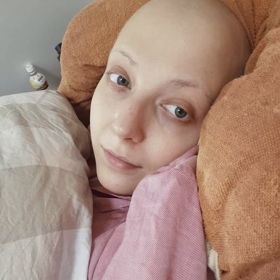 Anička Slováčková po chemoterapii.