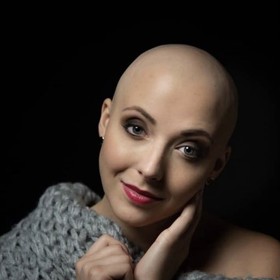 Anička Slováčková v době léčení zákeřné rakoviny.