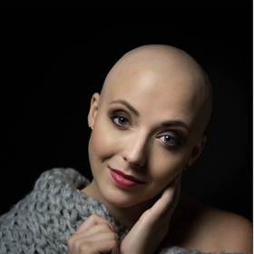 Anička Slováčková po chemoterapiích.