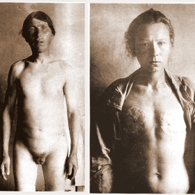 Kastrací a znetvořením se měli lidé přiblížit Bohu. Sex byl totiž považován za velký hřích.