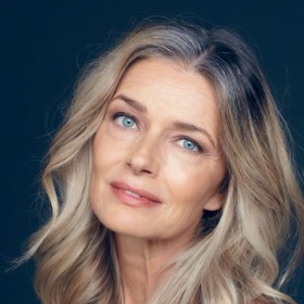 Naopak je hrdě ukazuje a rozhodně jí na kráse neubírají.