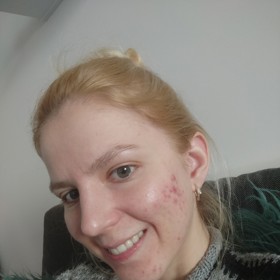 Postupně jsem se přestala používat dekorativní kosmetiku a alespoň trochu tím pleti ulevila.