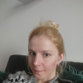 Největší mapy boláků se mi tvořily na tvářích.