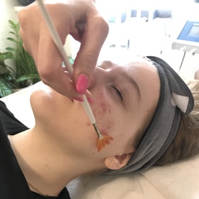 I maska na pleť by měla být správně zvolená, aby udělala službu, kterou potřebujete. 