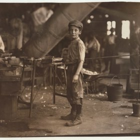 Ani práce v továrně na zápalky nebyla výhrou. Byť už jen kvůli fosforové nekróze čelisti.