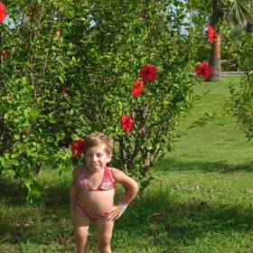 Monika Šimků se narodila se vzácnou genetickou vadou.