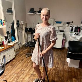 Přes všechna opatření Hanka nakonec o vlasy přišla. Začaly jí vypadávat po pramínkách - nejvíce na temeni, takže si podle svých slov připadala jako starší plešatící muž. V tu chvíli už věděla, že vlasy raději shodí, zavolala proto své kamarádce kadeřnici, která jí ochotně oholila hlavu strojkem.