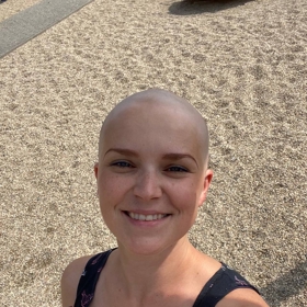 Hančin první den bez vlasů. Byl zrovna konec června a mladá maminka za sebou měla druhou dávku chemoterapie. "Milovala jsem to. Mít holou hlavu je úžasný pocit," svěřila se Hanka Samsonova.