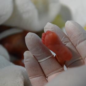 Před třemi lety zde bojovali o život dvojčátek-chlapečků paní Ivy, kteří se narodili císařským řezem ve 24. týdnu těhotenství. Jeden vážil 590, jeho bráška pak 690 gramů.