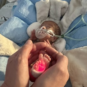 Každý rok se v České republice předčasně narodí kolem sedmi procent dětí. Zhruba 500 z nich má přitom porodní váhu pod hranicí jednoho kilogramu.