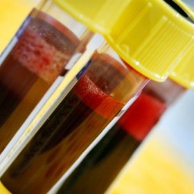 Zhubněte podle krevní skupiny. Stačí mít ten správný jídelníček!