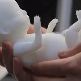 Ten totiž včas dokáže odhalit některé vývojové vady.