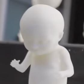 Podle trojrozměrného modelu dokonce můžete poznat, komu je dítě podobné.