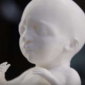 V případě, že nemáte žádné pohybnosti o zdraví dítěte, není lepší se přeci jen nechat překvapit?