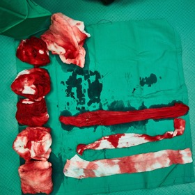 Krev je životodárná tekutina