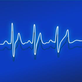 Pro zrovna jméno Wow? Dr. Jerry Ehmamem totiž při zachycení tohoto zvláštního signálu napsal k jeho kódu, který byl vytištěný na kusu papírku anglické slovo Wow. Jméno už zůstalo