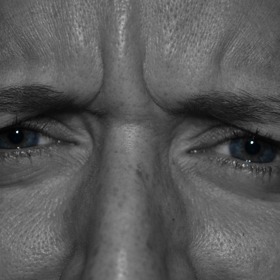 neléčené šilhání může trvale poškodit zrak