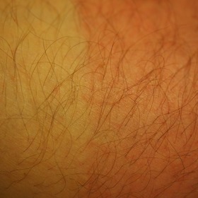 Vždy se před sluncem chraňte.